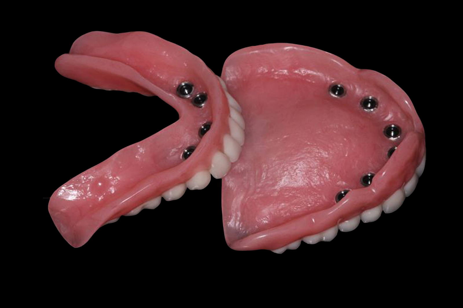 Implant Supported Dentures